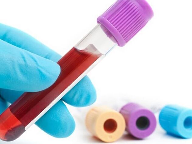 Laboratorijas metodes